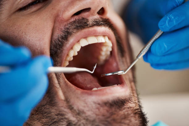 Full Mouth Reconstruction in Kenhorst, PA